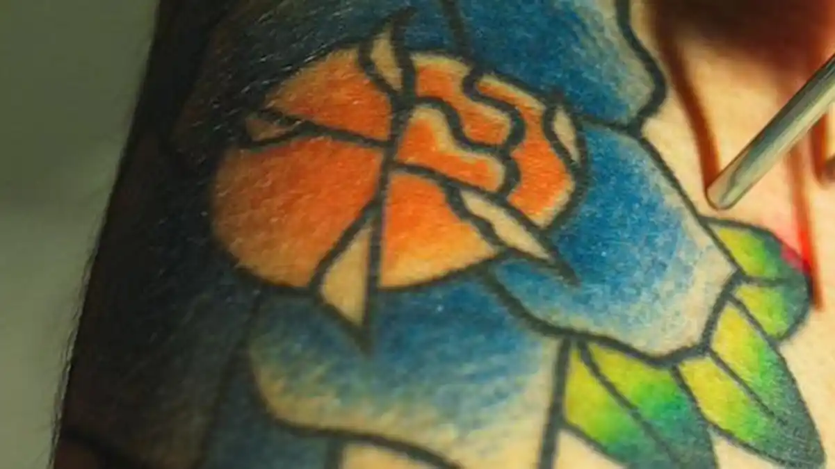 Eliminacion de tatuajes
